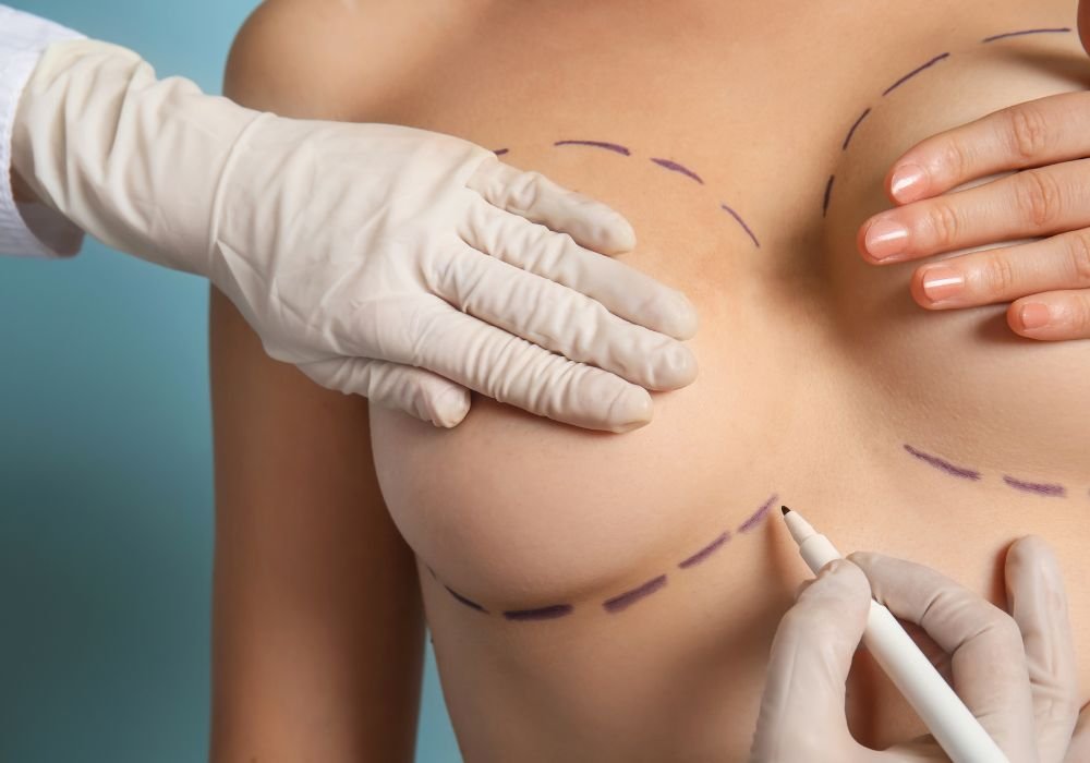 Chirurgie mammaire - augmentation et réduction à Genève